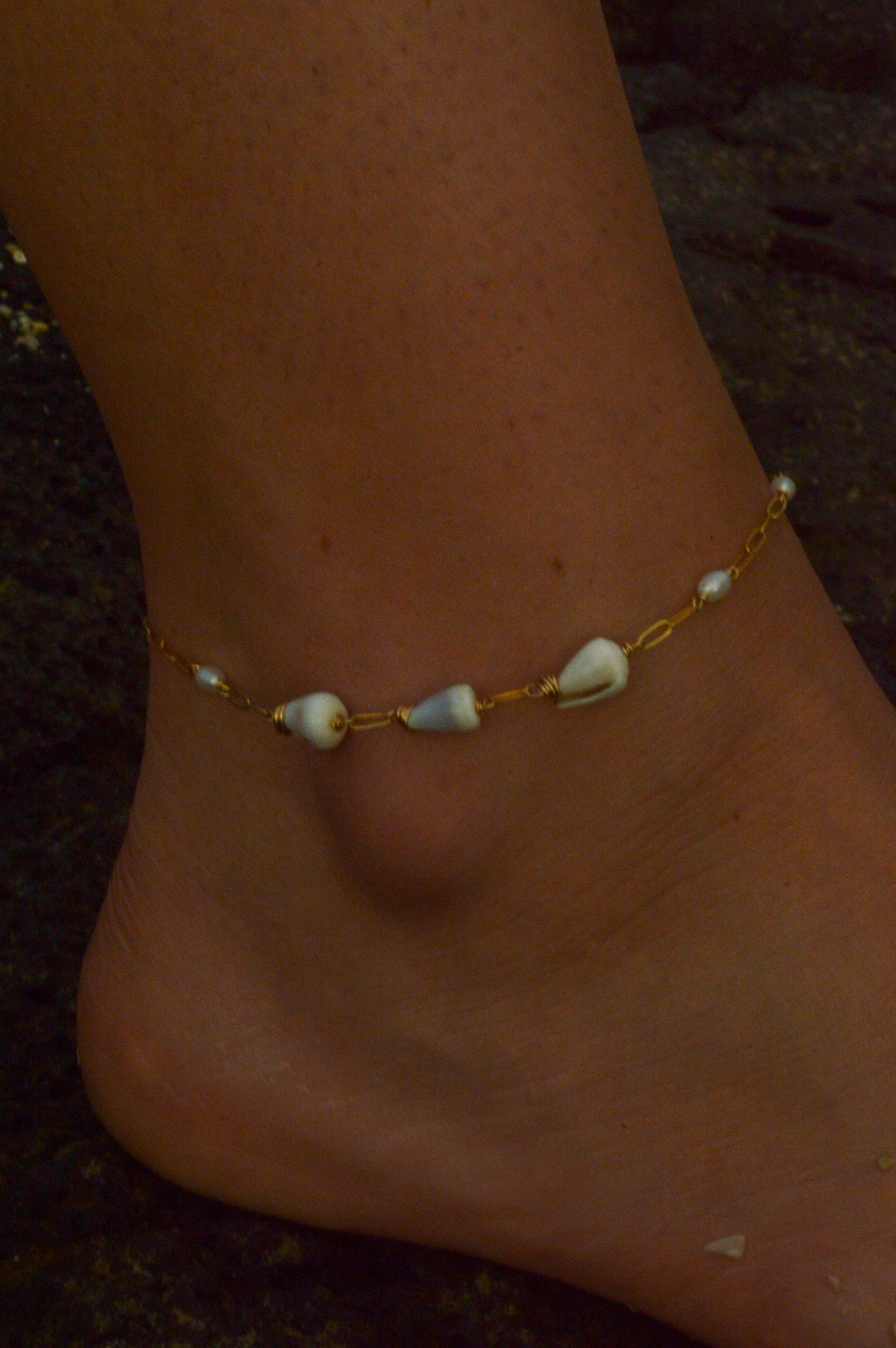 Cone Shell Anklet